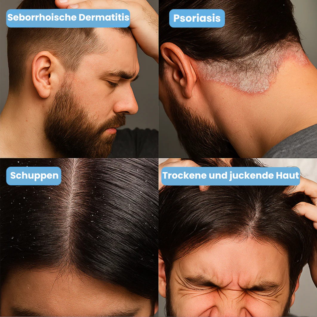 Nusevia Creme | Beruhigte Haut & Kopfhaut