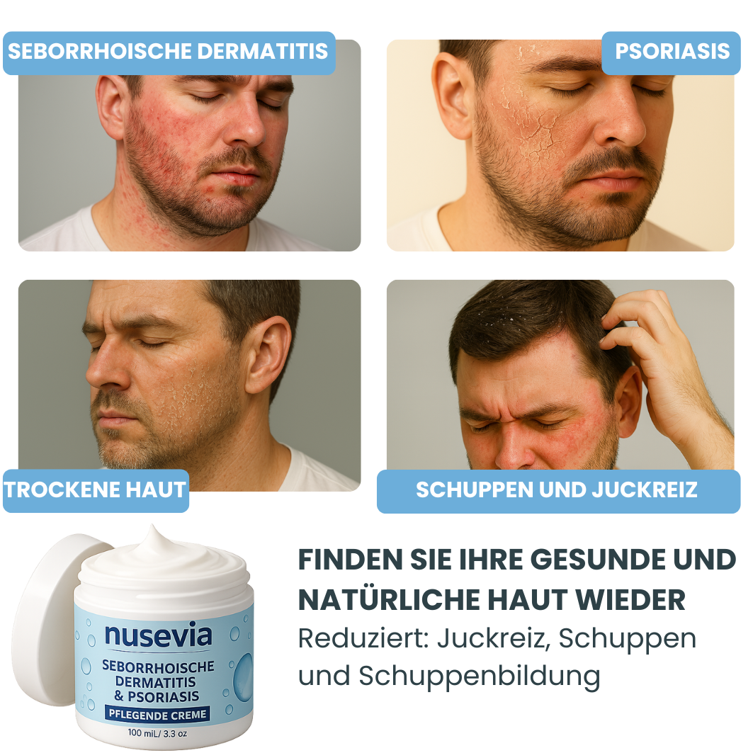Nusevia Creme | Beruhigte Haut & Kopfhaut